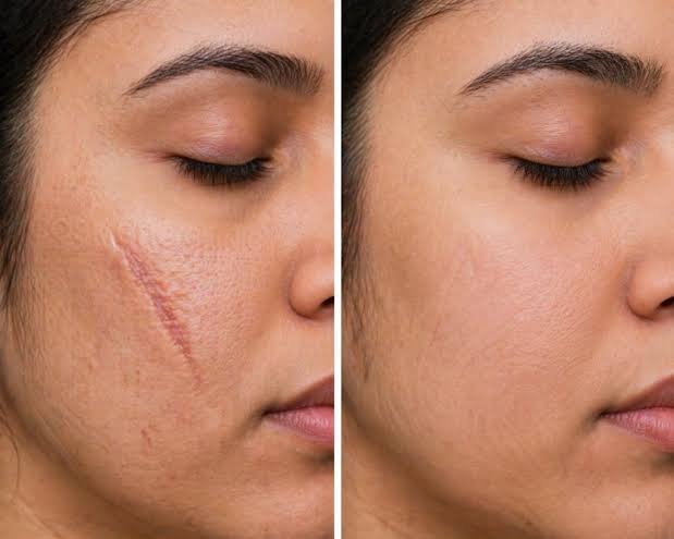 Facial Aesthetic Surgery