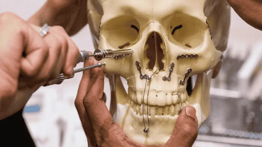 Facial Trauma Management